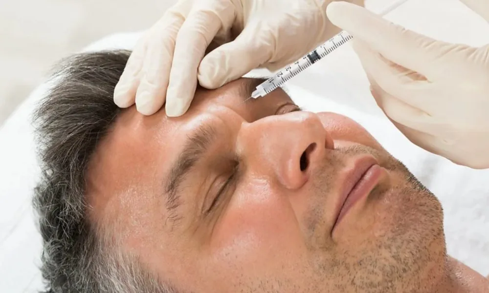 Fillerbehandling med injektion i pannan på patient hos BeautyFillers Stockholm