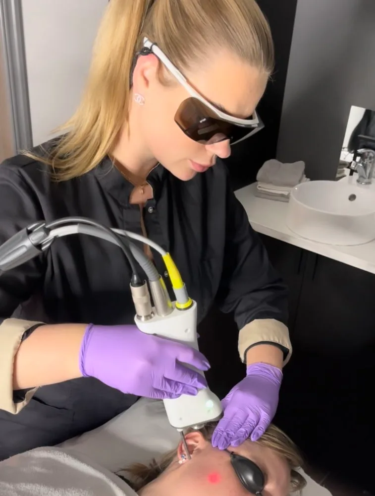 Laserbehandling i ansiktet hos Cosmetics and Beauty Malmö