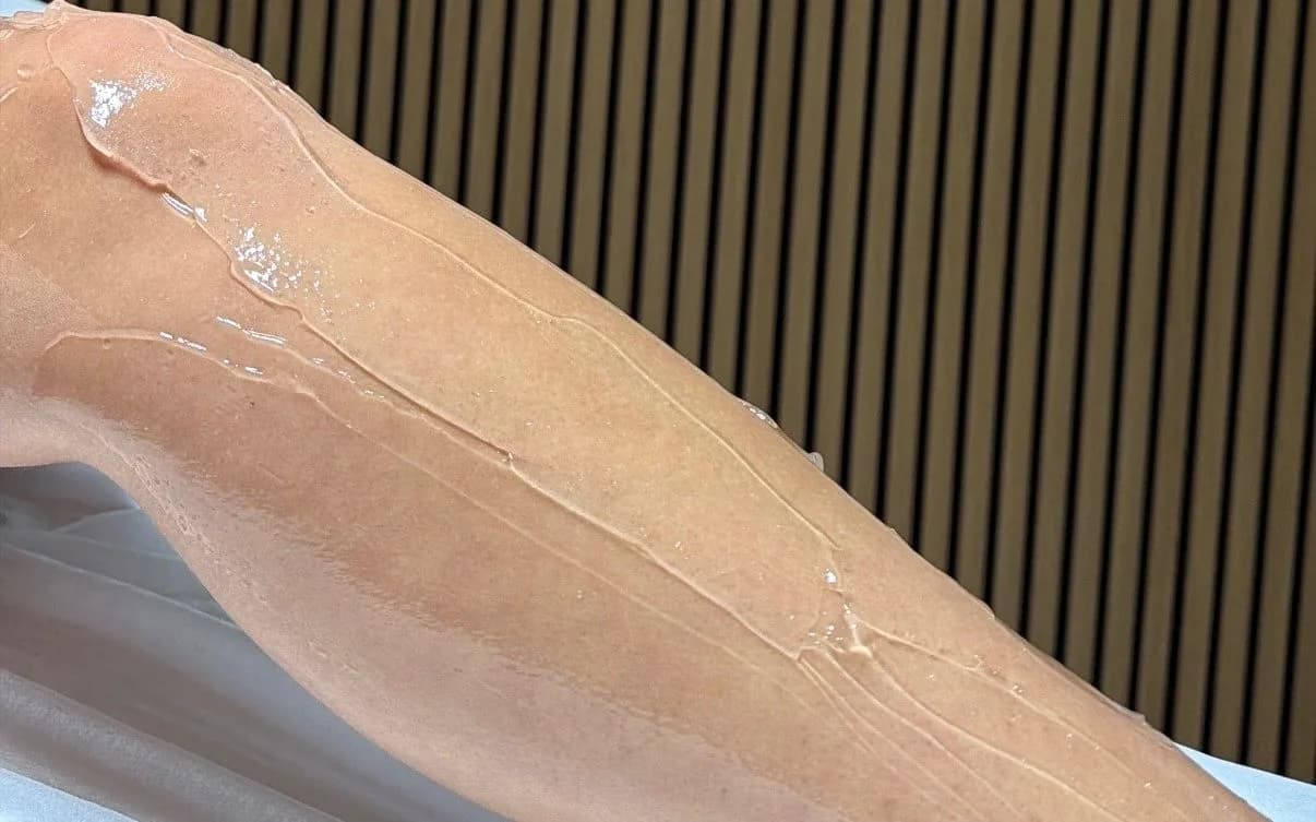 Ben med gel inför laserhårborttagning hos Elitelaser by Enji i Malmö