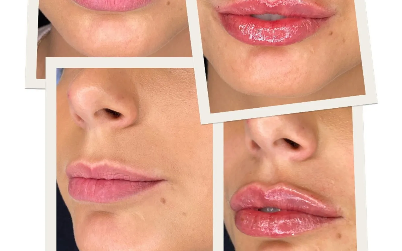 Exklusiv Estetik skönhetsklinik vid Skanstorget i Göteborg