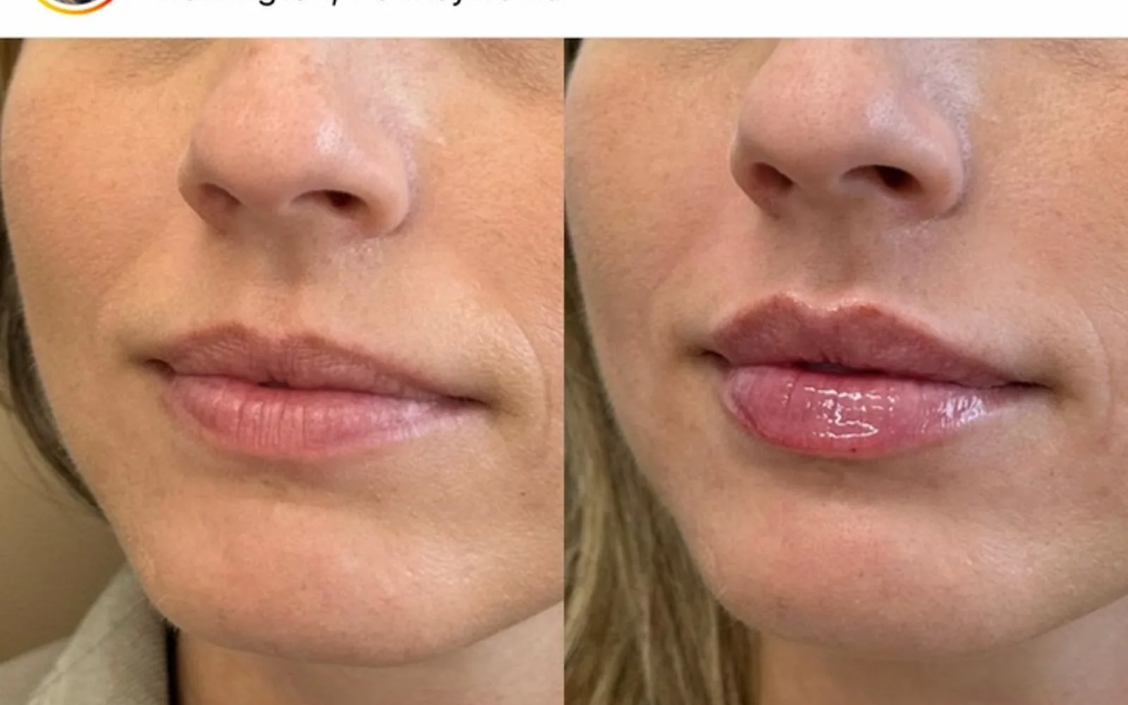 Behandlingsrum på Fine Clinic Enskede i Salong Blond på Nynäsvägen