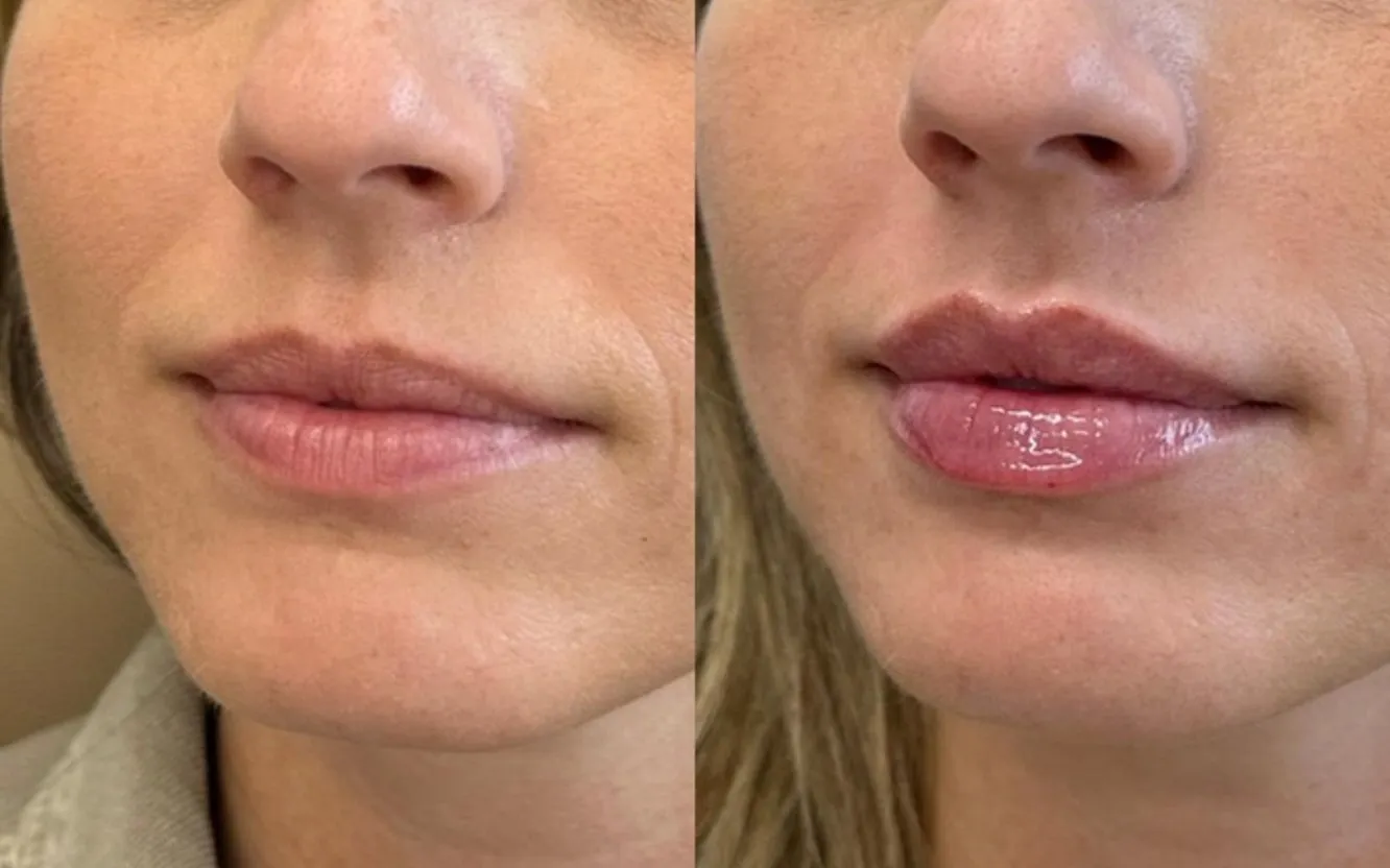 Behandlingsrum på Fine Clinic Vasastan i Stockholm