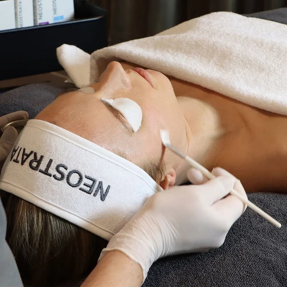 Kemisk peeling appliceras hos illume by Emelie vid Odenplan i Stockholm