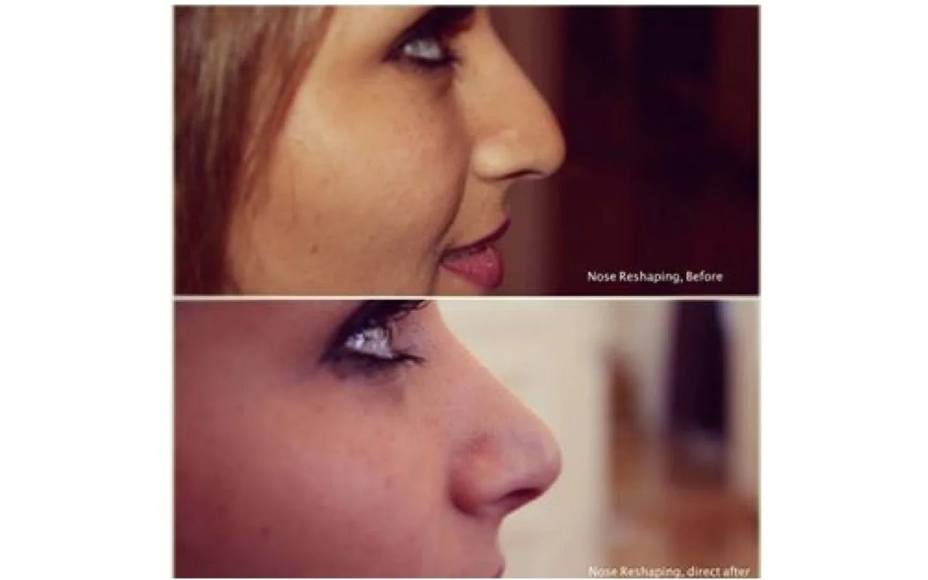 Laser Focus Clinique estetisk klinik i Göteborg