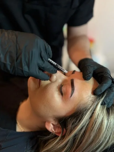 Injektionsbehandling vid näsroten på Malmö Skin Clinic