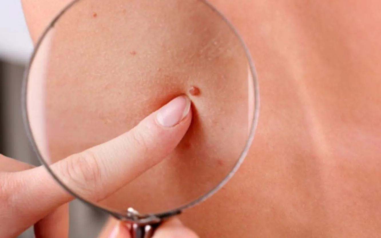 Behandlingsrum hos MBC Medical på Linnégatan i Göteborg