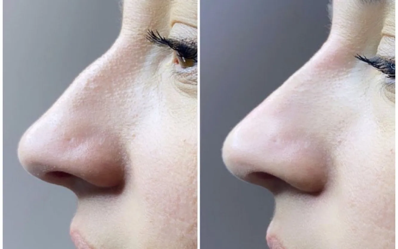 Interiörbild från Nellphoria klinik på Upplandsgatan i Stockholm