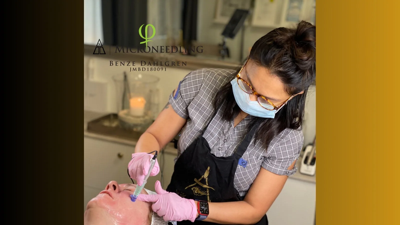 Microneedling i behandlingsrummet hos Plusbeauty i Malmö