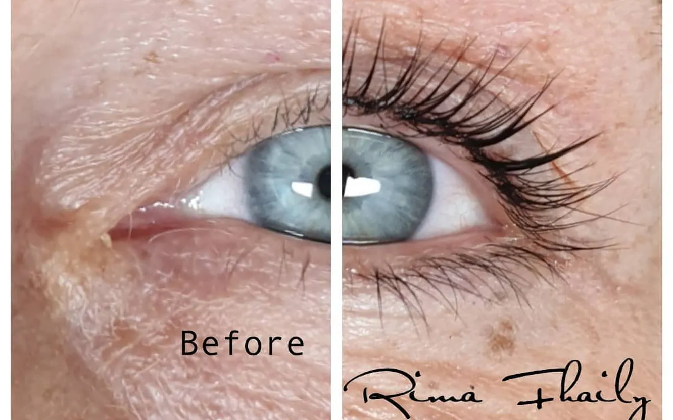 Behandlingsrum hos Rima Belle i Göteborg med skönhetsterapeut