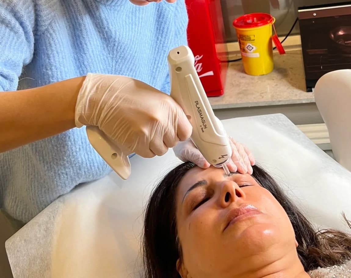 Plasmapenbehandling hos Skin Focus Clinic i Hyllie, Malmö