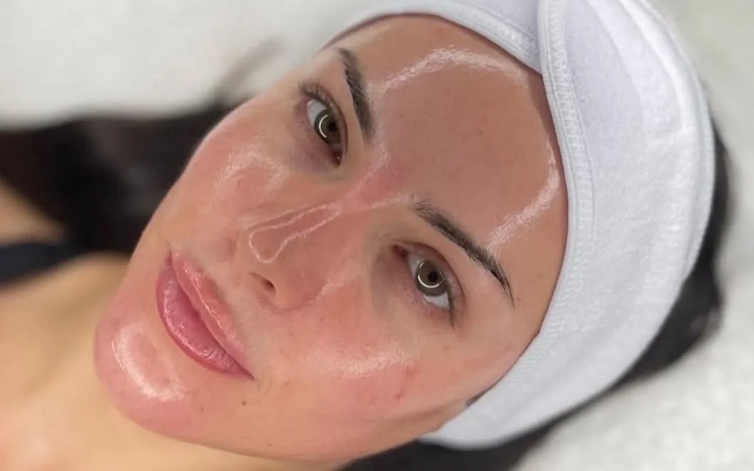 Kund med återfuktad hy efter ansiktsbehandling på Skinfinity i Malmö