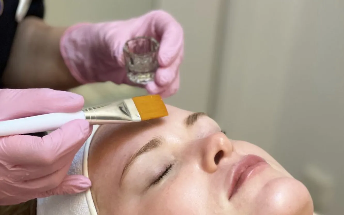 Kemisk peeling appliceras under hudbehandling hos Ung För Evigt i Stockholm